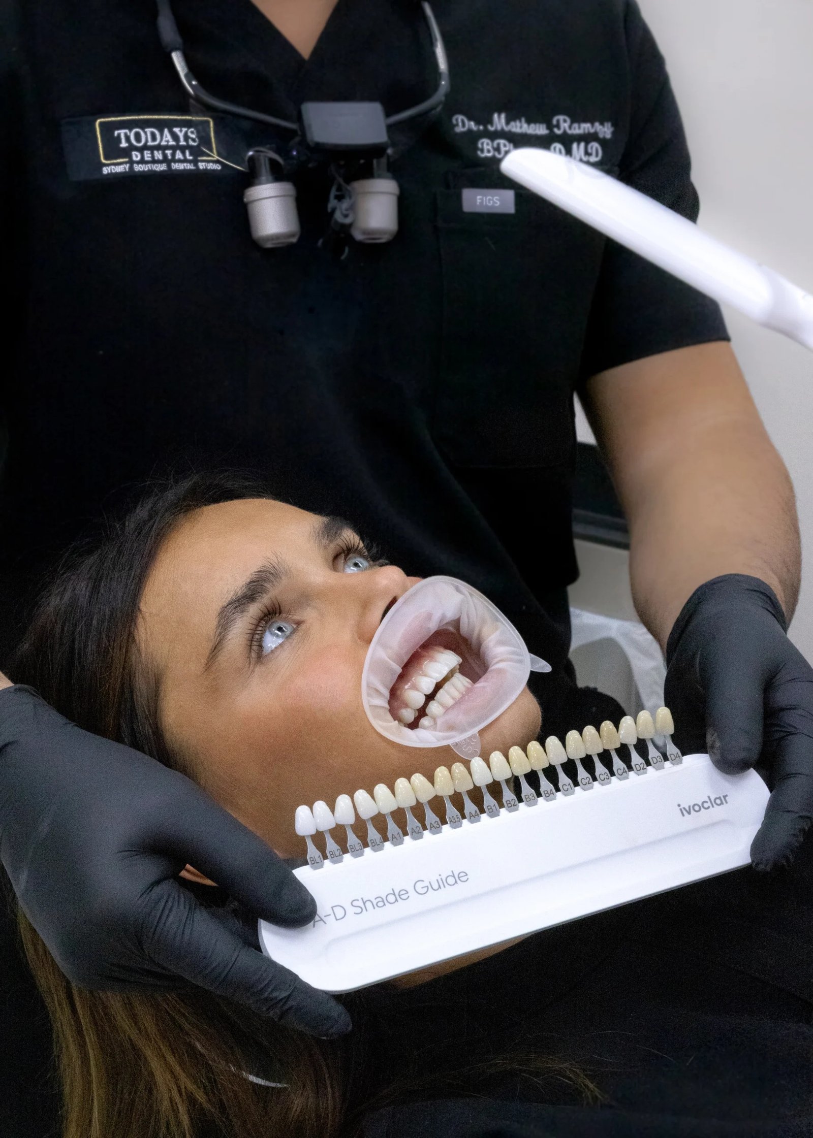 Composite-Resin-Veneers-scaled.webp
